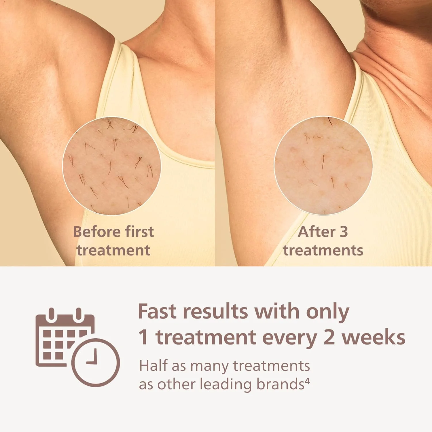 Philips Lumea 8000 Series IPL Hair Removal, Permanent Laser Hair Reduction for Women & Men, Easy and Comfortable Use at Home, SenseIQ, 2 Attachments for Body & Face, BRI932/03