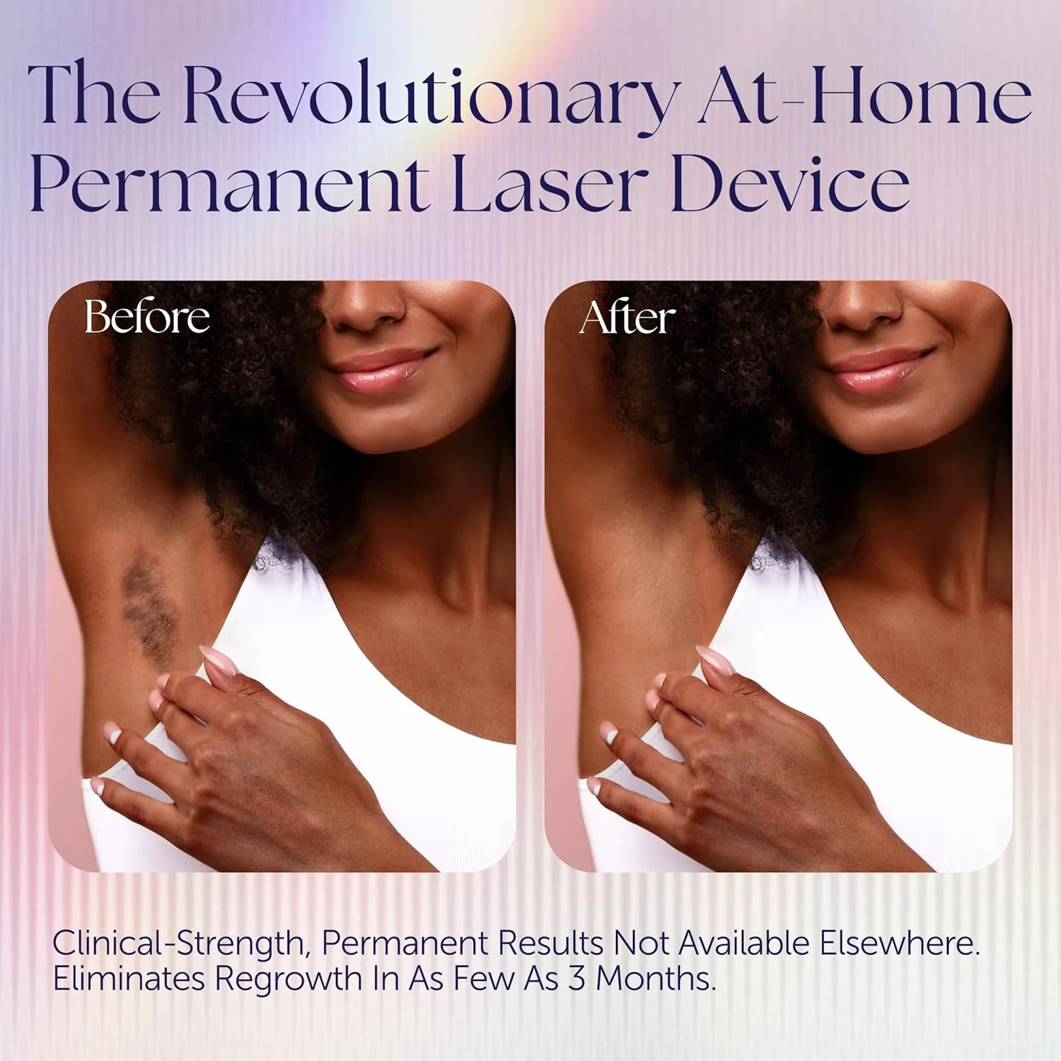 Epilaser Dark Skin At-Home Laser Hair Removal, Safe - Won’t Cause Skin Bleaching, Hypopigmentation | Intelligent, Clinical Strength, Painless Permanent Hair Removal for Face, Body, Bikini Line