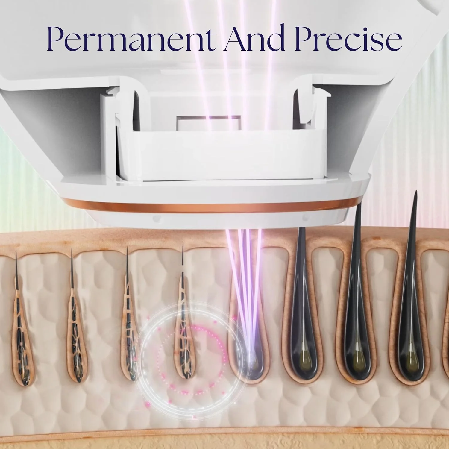 Epilaser At-Home Laser Hair Removal Device for Light Skin, Safe, Intelligent, Painless and Permanent Hair Removal for Face, Body, Bikini Line (Light Skin)