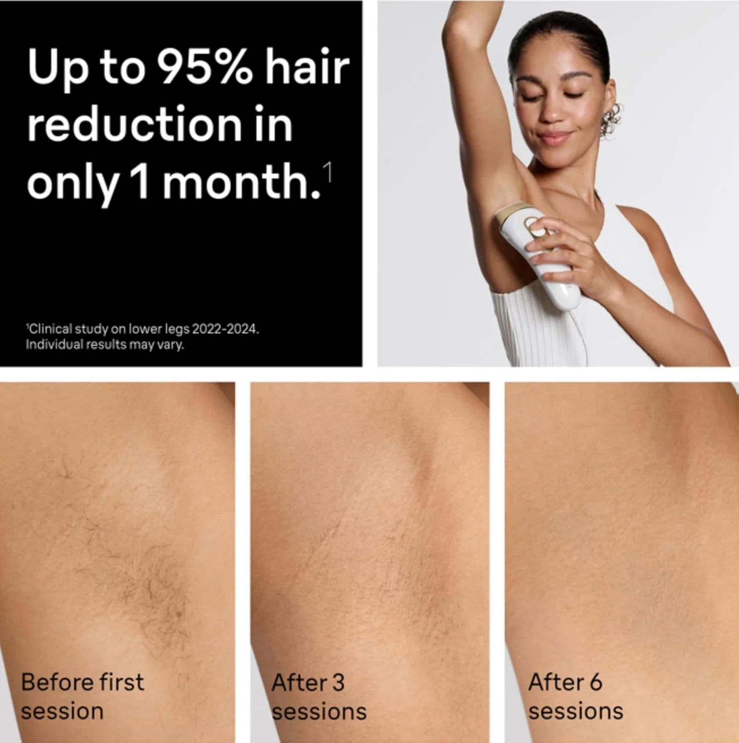 Braun Smart IPL, Silk·Expert Pro 5: at Home Laser Hair Removal for Women and Men, Permanent Visible Hair Reduction in Hair Regrowth for Body & Face, Wide Head and Two Precision Heads, IPL5347