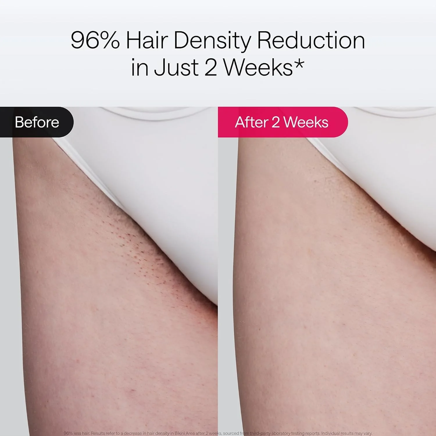 Ulike Laser Hair Removal Device Air 10 Ipl Gift for Women and Men, Ice Cool and Permanent Hair Reduction for Nearly Painless, Dual Lights, Skin Sensor & USHR Mode Hair Removal in 10mins from Home
