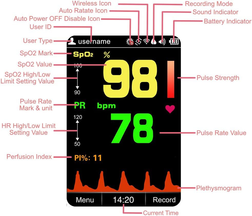 Viatom Handheld Pulse Oximeter for Adults and Baby, Up to 580 Hours of Storage Data Accurate SpO2 & Pulse Rate