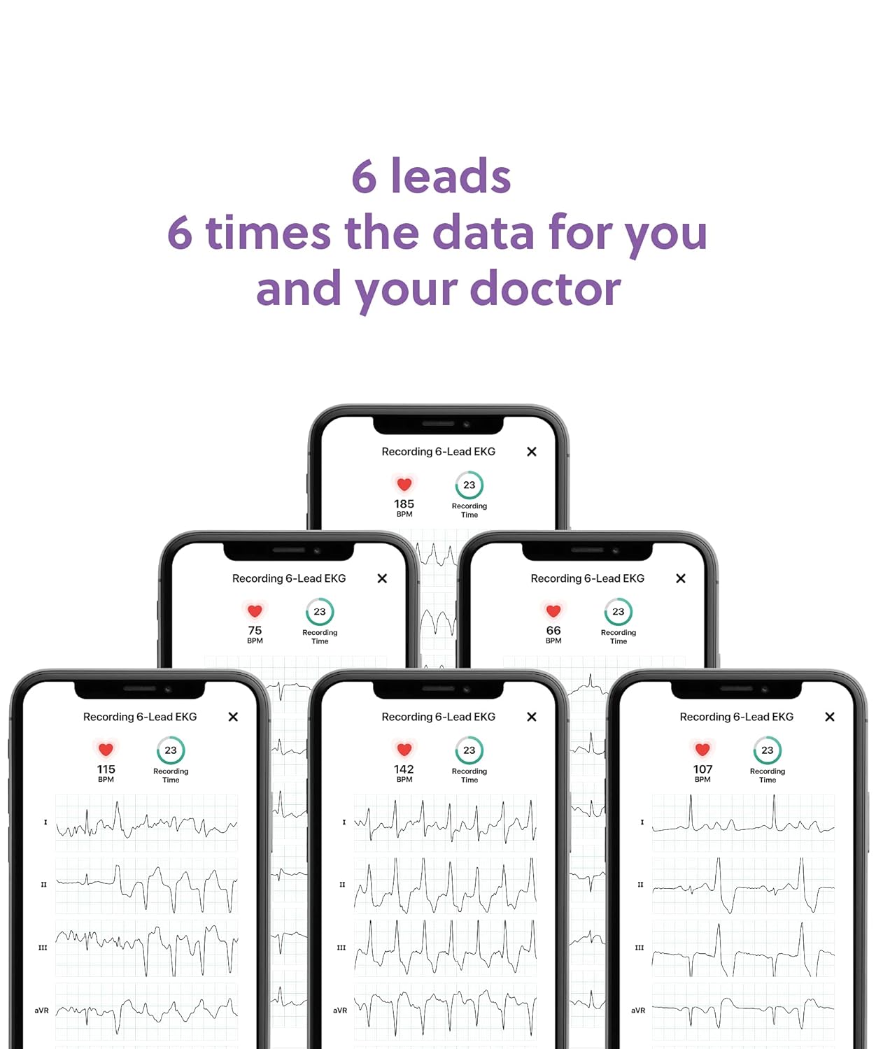 AliveCor KardiaMobile 6L Personal EKG Device and Heart Monitor | Detect AFib and PVCs from Home | 6 Arrhythmia Detections with KardiaCare (Includes 1 Year Access) | FDA-Cleared |
