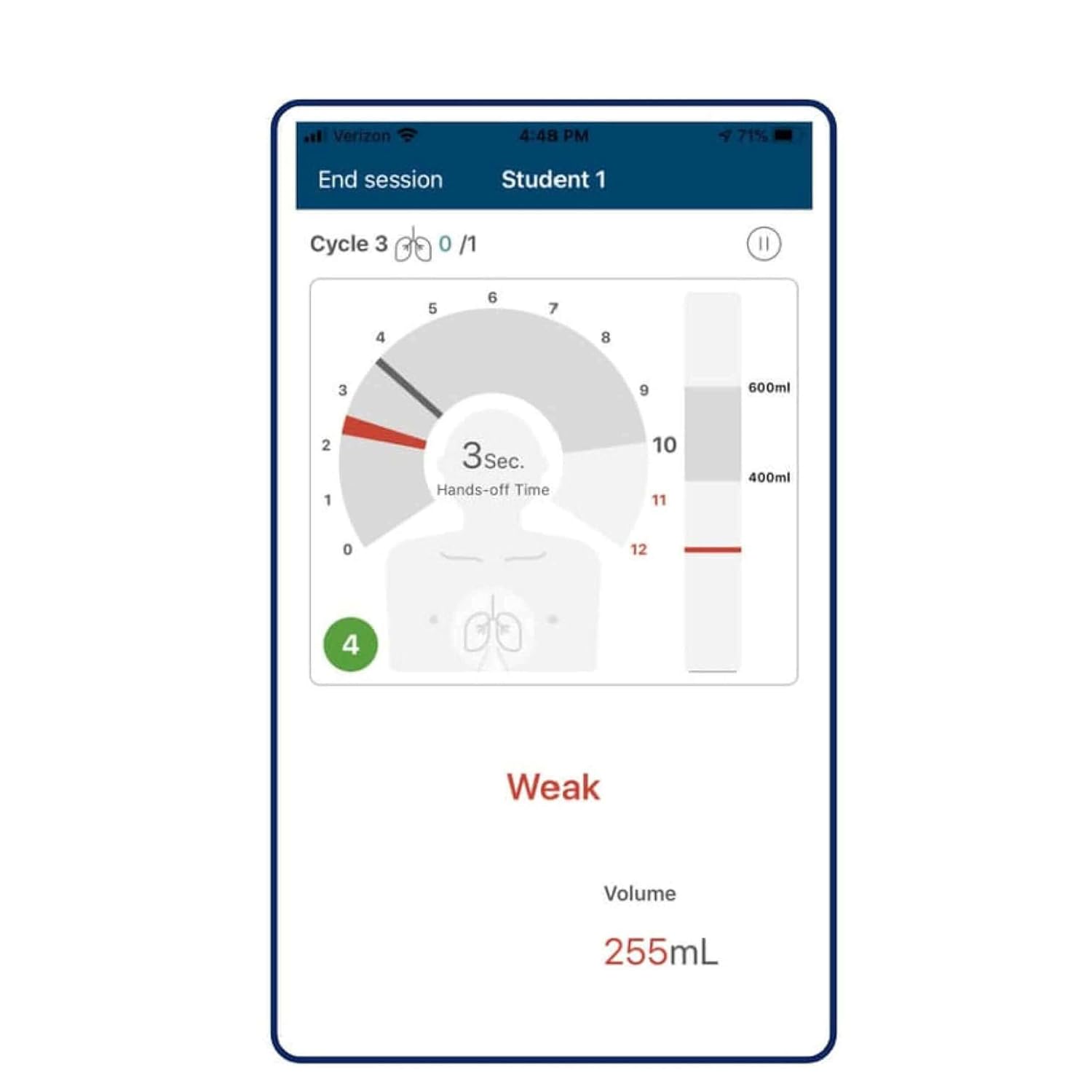 Prestan Products PRESTAN PP AM 2000 1 DS Adult Series 2000 CPR Training Manikin with Advanced Feedback Dark Skin