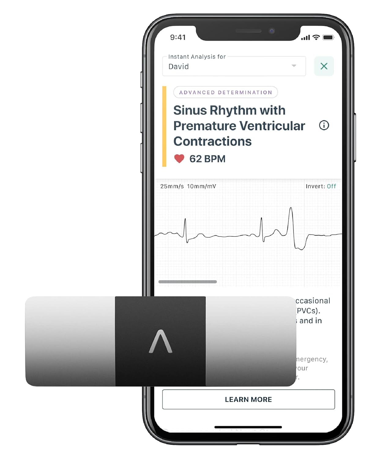 AliveCor KardiaMobile 6L Personal EKG Device and Heart Monitor | Detect AFib and PVCs from Home | 6 Arrhythmia Detections with KardiaCare (Includes 1 Year Access) | FDA-Cleared |