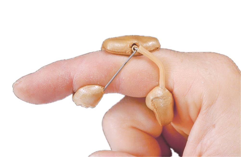 DeRoyal LMB Spring PIP Extension Assist (Model 504) Spring PIP Extension ASSIST, 504, Large - Finger Contracture