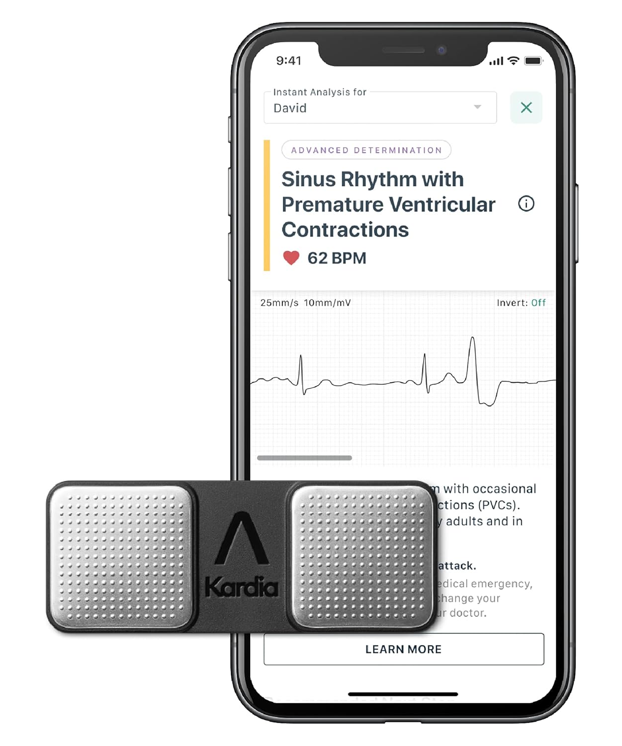 KardiaMobile Personal EKG Device and Heart Monitor - Detect AFib, PVCs and Other Arrhythmias from Home - 7 Detections with KardiaCare (includes 3 month access) - FDA-Cleared - By AliveCor
