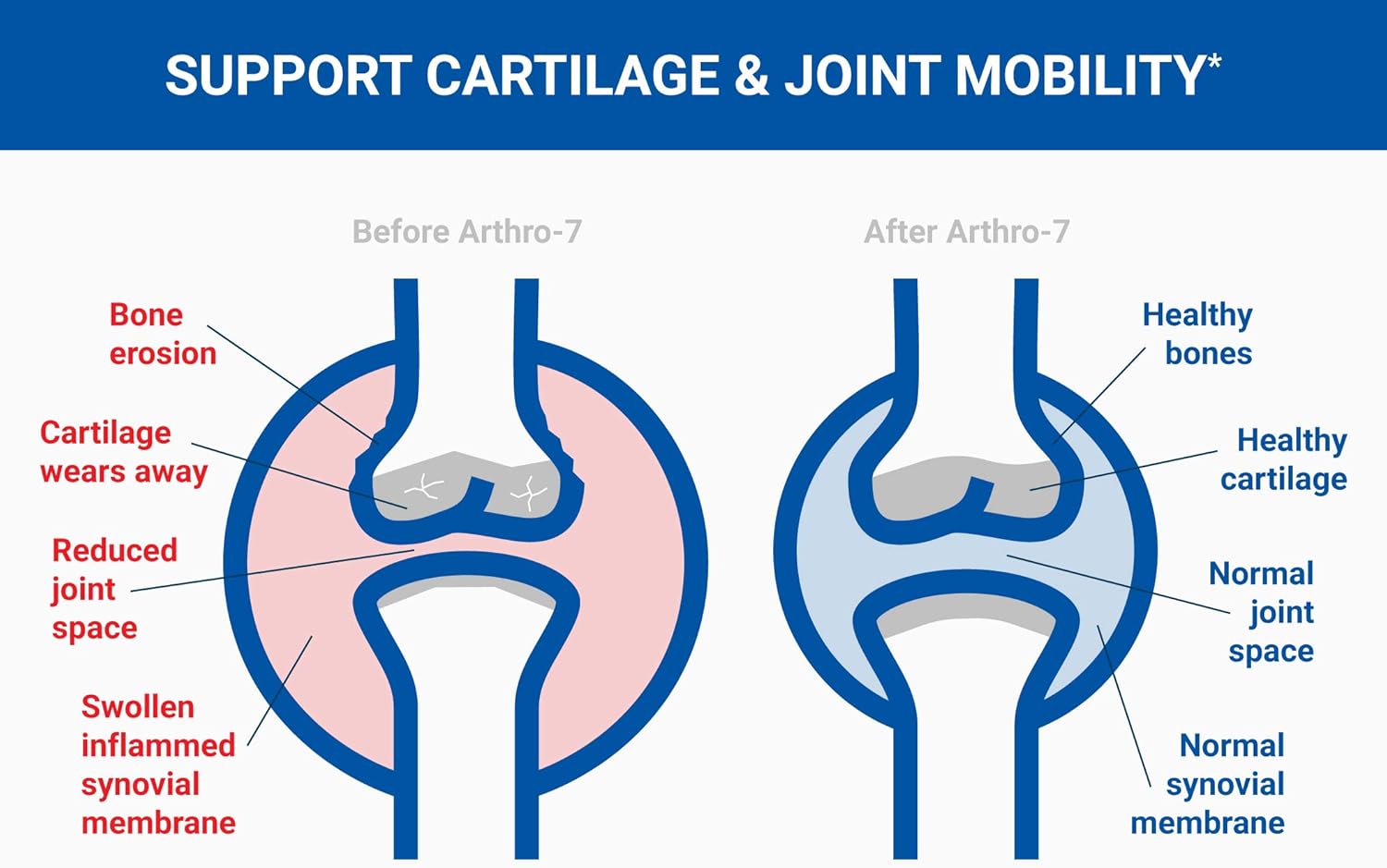 U.S. Doctors’ Clinical Arthro-7 Joint Supplement Original Formula w/ 7 Joint Nourishing Ingredients for Joint Discomfort, Stiffness, Walking, Joint Health - Packaging May Vary [3 Month - 180 Count]